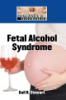 Fetal_Alcohol_Syndrome