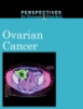 Ovarian_cancer