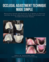 Occlusal_Adjustment_Technique_Made_Simple